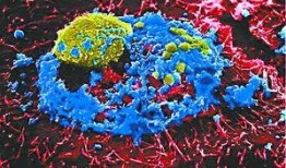 新闻爆料禽流感病毒,紧急应对与防控措施升级